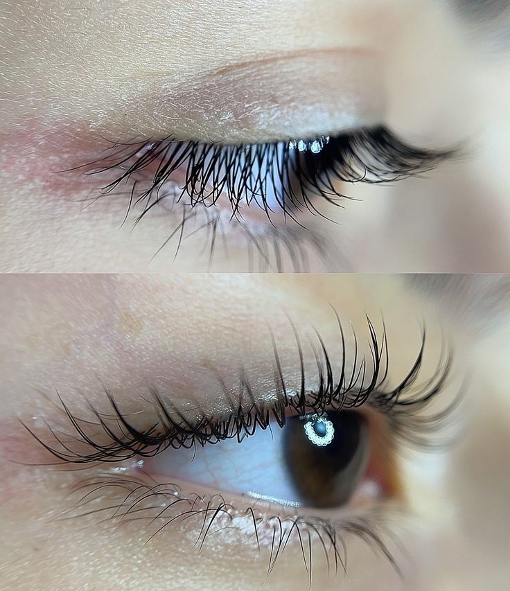 Lash Lift